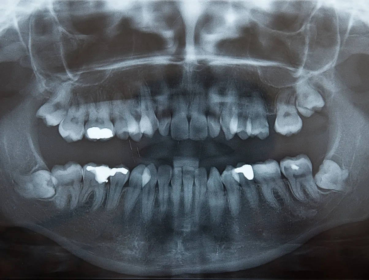 RTG prístroj SK Dental Bratislava